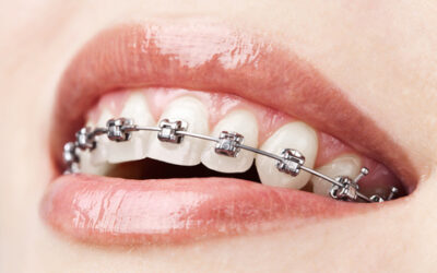 A Helpful Site on Orthodontics