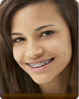 How Old Is Too Old for Braces?