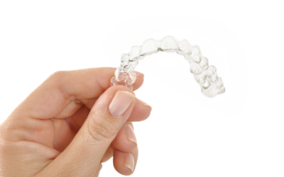 How Long Do I Have To Wear Invisalign?