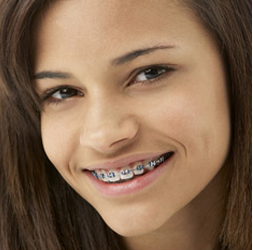 How Old Is Too Old for Braces?