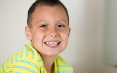 The Truth About Braces: Busting the Top 5 Orthodontic Myths