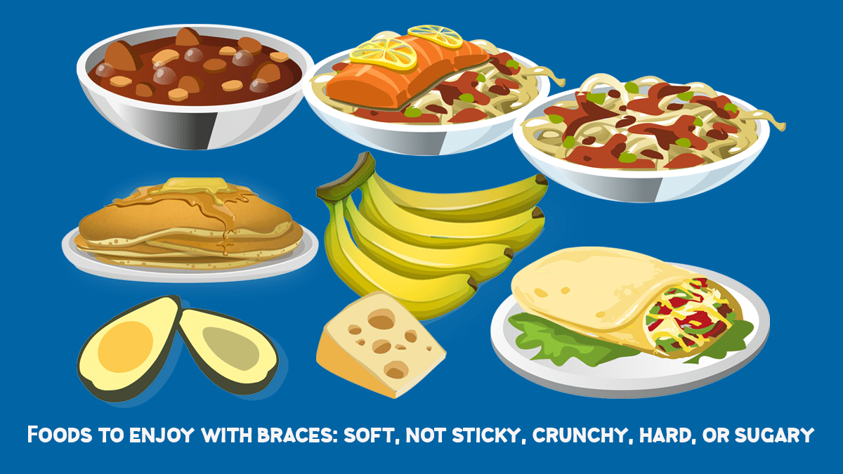 Foods To Eat With Braces: Delicious Options And What's Best Avoided