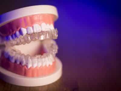 Invisalign Treatment Explained: The Ultimate Guide to a Better Smile