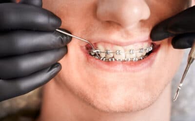 4 Tips for Using Dental Insurance for Braces & Invisalign