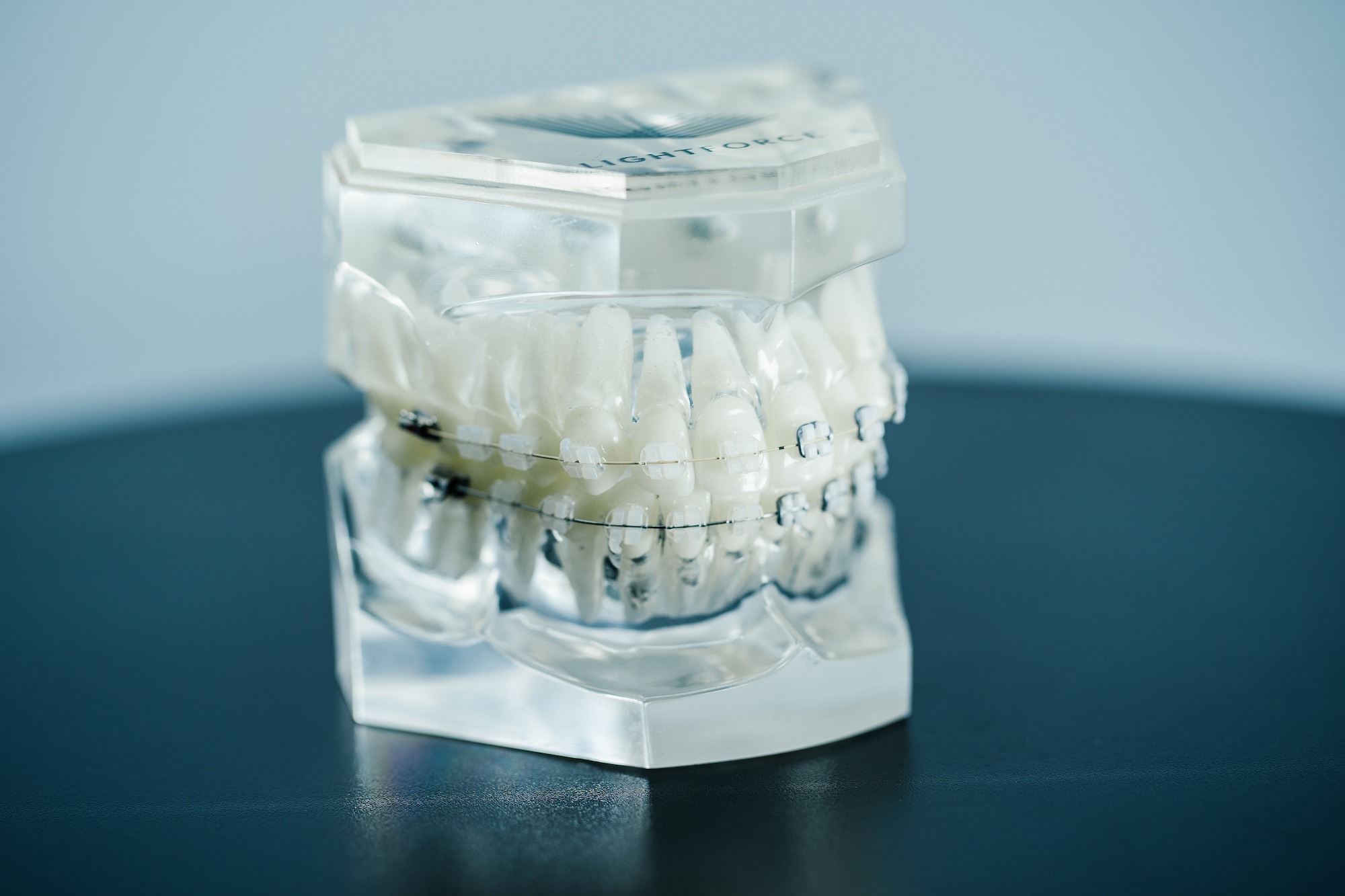 LightForce Clear Braces