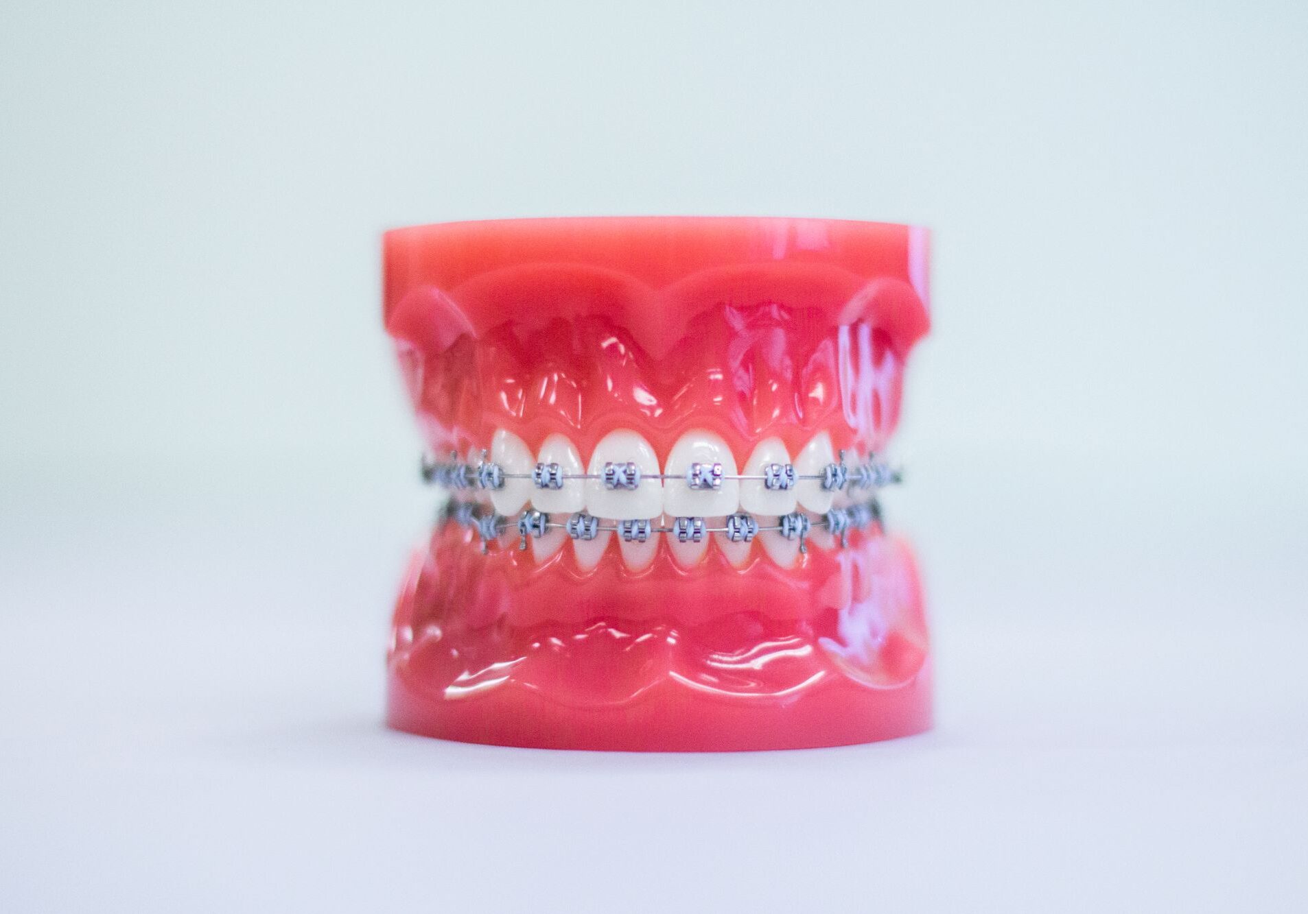 Metal Braces