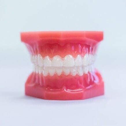 treatment-invisalign