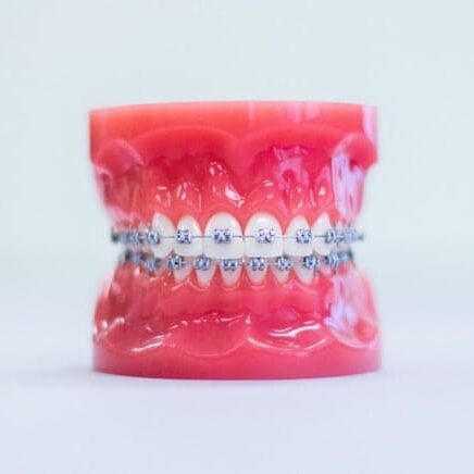 treatment-metal-braces